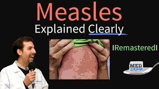 Measles Symptoms Diagnosis Vaccine Treatment Explained [upl. by Eisso]