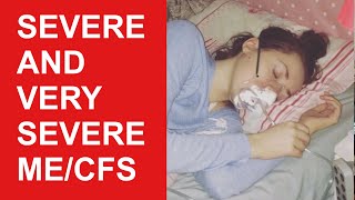 Severe and Very Severe MECFS Myalgic EncephalomyelitisChronic Fatigue Syndrome [upl. by Salta111]