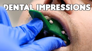 Dental Impressions amp Pouring Teeth Models [upl. by Htebiram719]