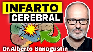 INFARTO CEREBRAL ICTUS Causas Síntomas Tratamiento y Prevención [upl. by Enirehtahc561]