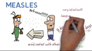 Measles  What is it [upl. by Brill]