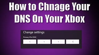 How to Change Your DNS on Your Xbox One Console [upl. by Oiludbo]