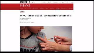 Measles and the MMR vaccine [upl. by Euqinobe]