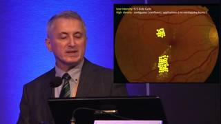 EuretinaESCRS 2015  Treatment of Chronic Central Serous Chorioretinopathy [upl. by Fesoj560]